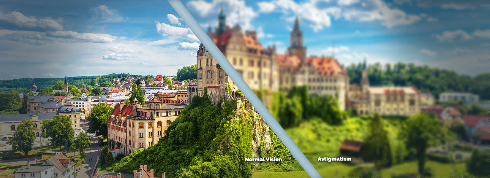 Astigmatism Treatment in Westside
