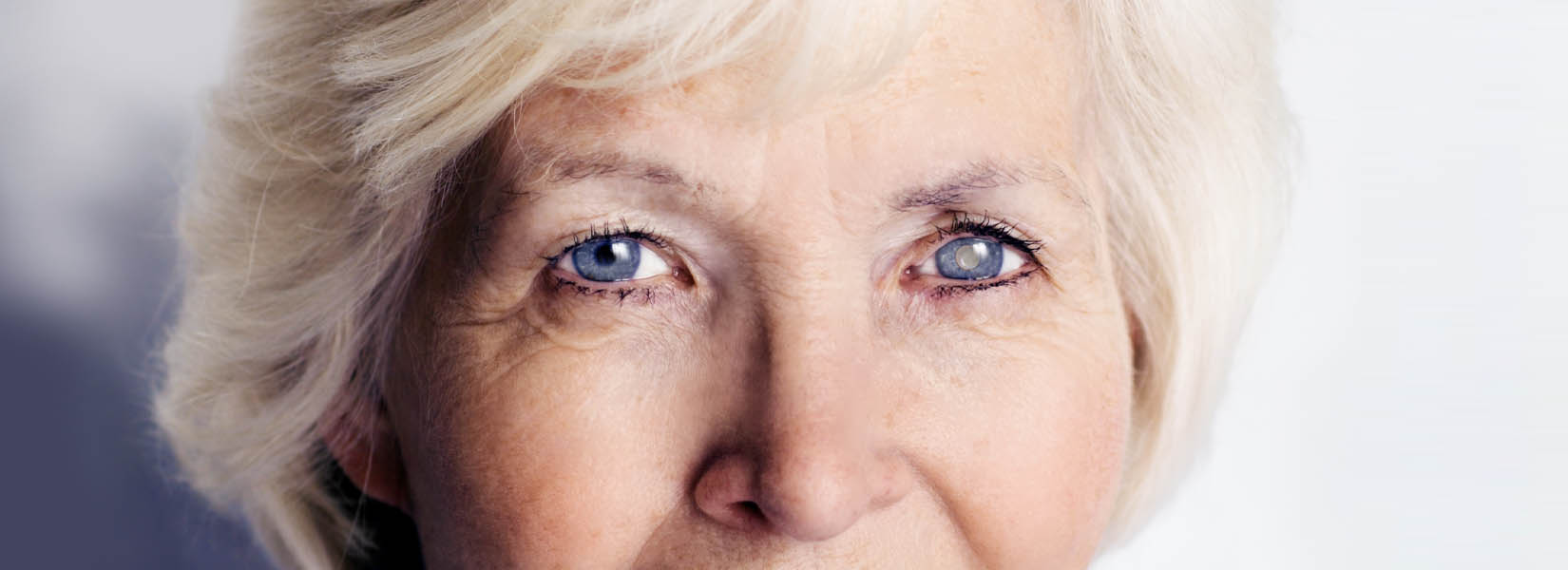Cataract Surgery in Westside